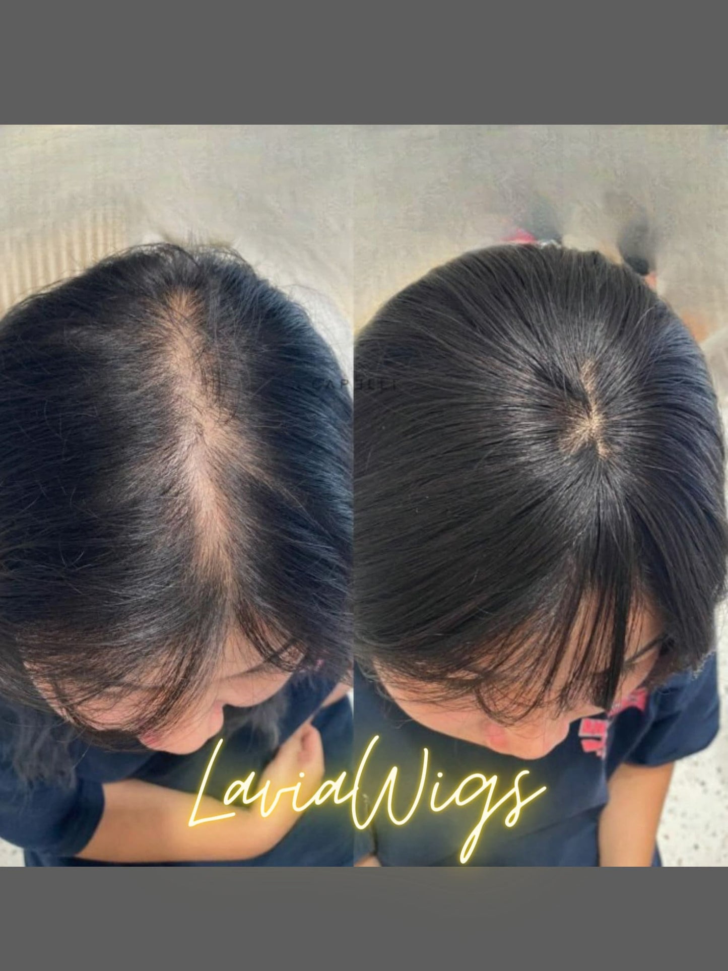 Lavia, silk based Mini Hair Topper Plus, real human hair, best for hair thinning solutions, slight hair loss on top head, medium density